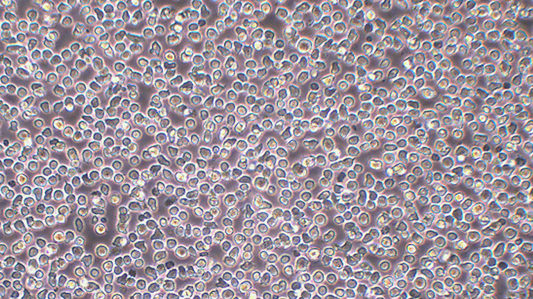 RS4;11人急性淋巴白血病细胞