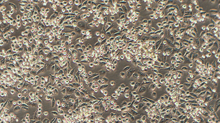 MIA PaCa-2人胰腺癌细胞