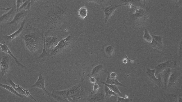 NCI-H28人间皮瘤细胞