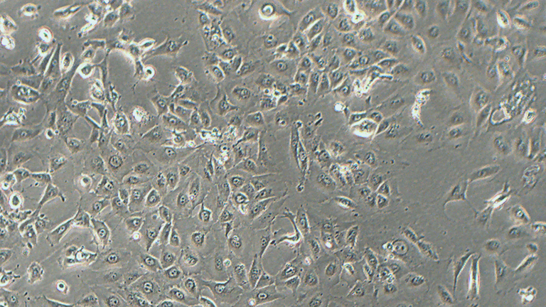 NCI-H226人间皮瘤细胞