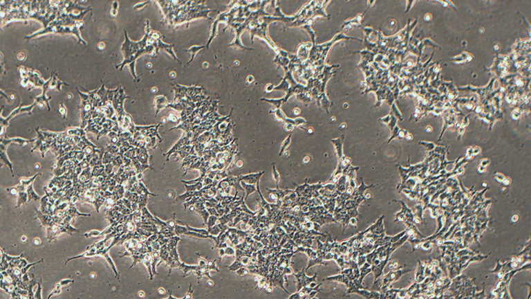 HEK-293人胚肾细胞