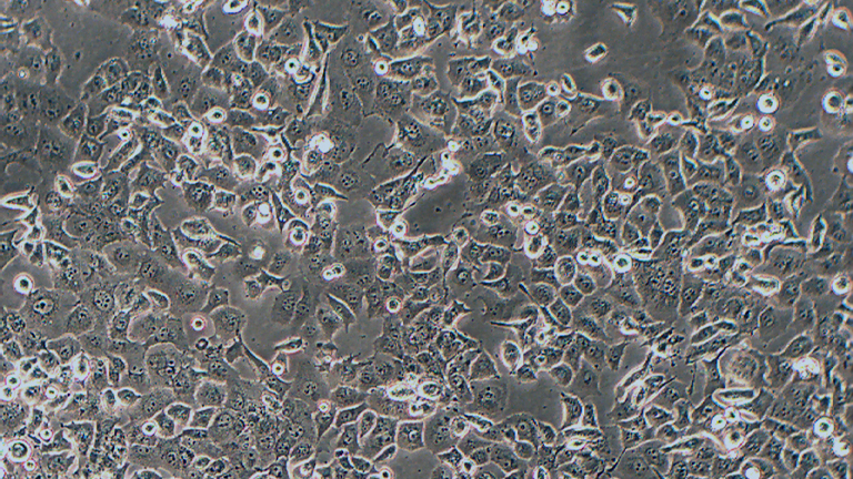Panc-1人胰腺癌细胞（未分化）