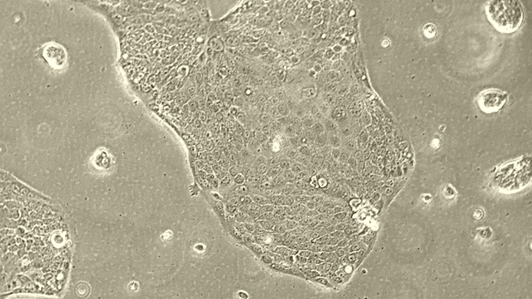 Capan-2人胰腺癌细胞（高分化）
