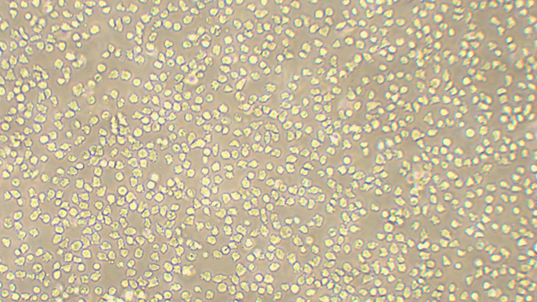 NALM6 B系急性淋巴细胞白血病细胞