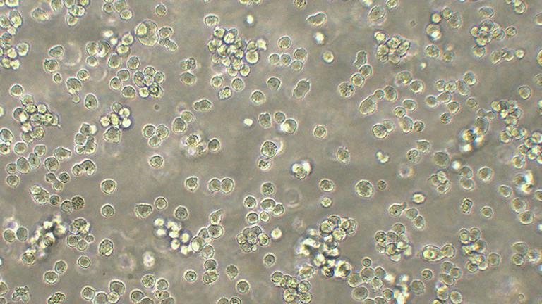 NB-4人急性早幼粒白血病细胞