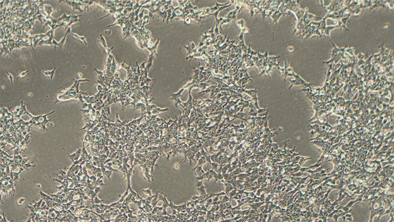 IMR-32人神经母细胞瘤细胞