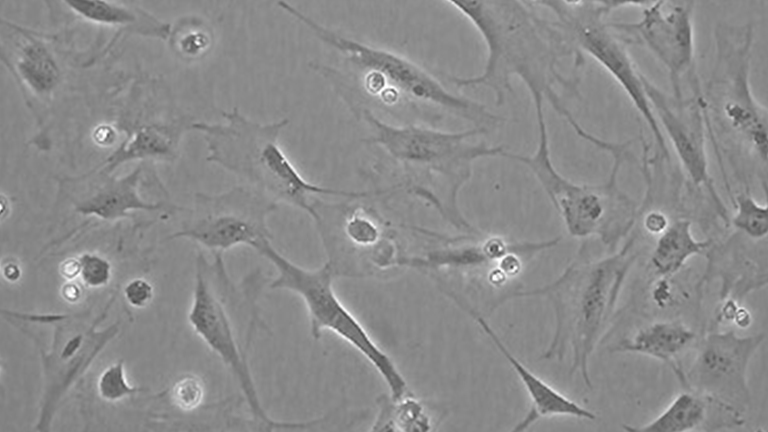 3T3swiss swiss小鼠胚胎成纤维细胞