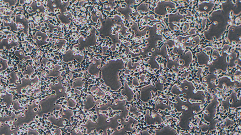 293T SV40T转化的人胚肾细胞