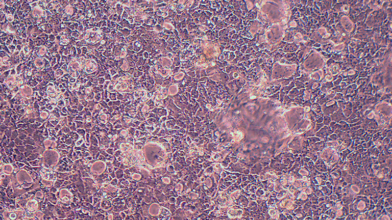 Caco-2人结直肠腺癌细胞