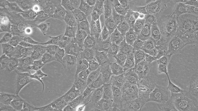 C127小鼠乳腺肿瘤细胞