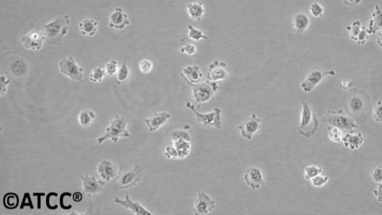 NCI-H23人非小细胞肺癌细胞