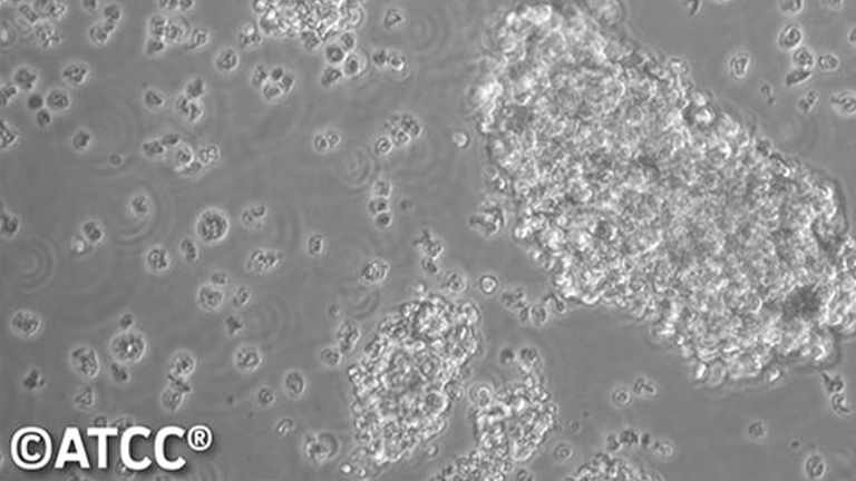 NCI-H524人小细胞肺癌细胞