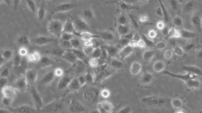 Nthy-ori 3-1人甲状腺滤泡上皮细胞