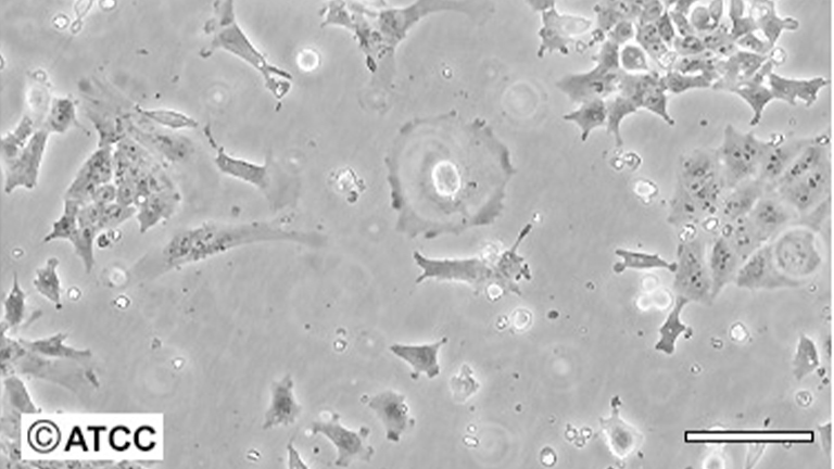 P19小鼠畸胎瘤细胞