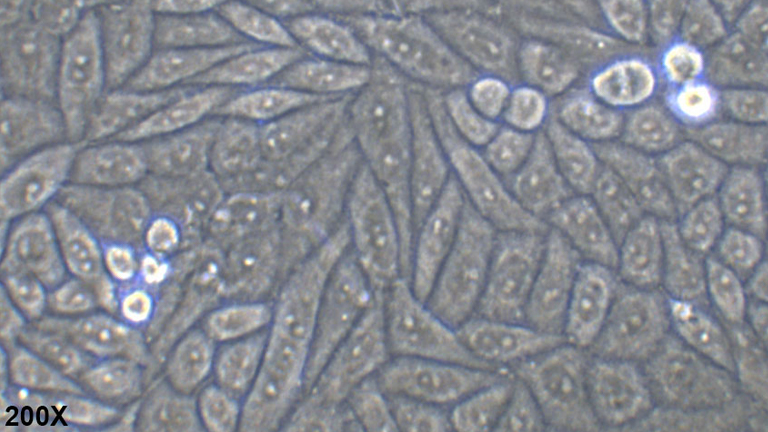 SiHa人子宫颈鳞状细胞癌细胞