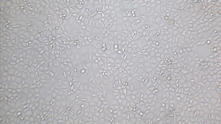 SW-13人肾上腺皮质小细胞癌细胞