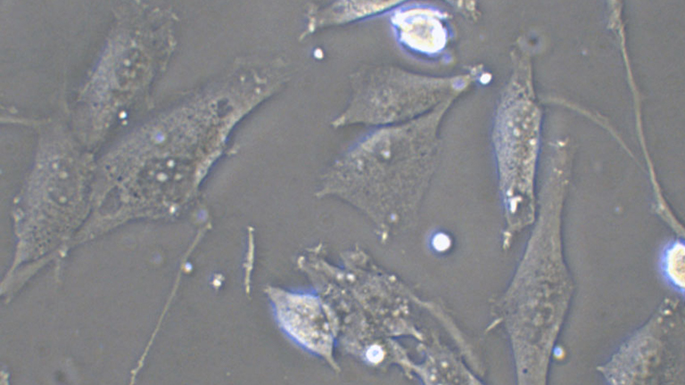 U-118 MG人脑星形胶质母细胞瘤细胞