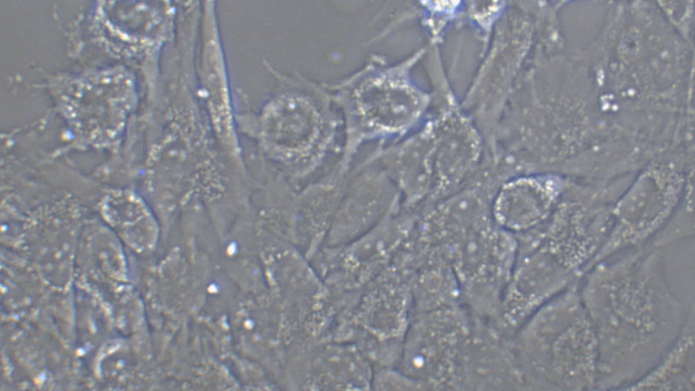 SW1088人脑星形胶质细胞瘤细胞