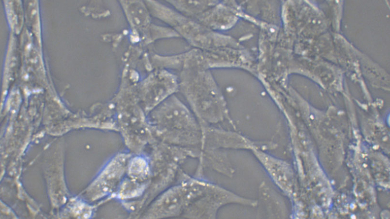 MOG-G-UVW人脑星形胶质细胞瘤细胞