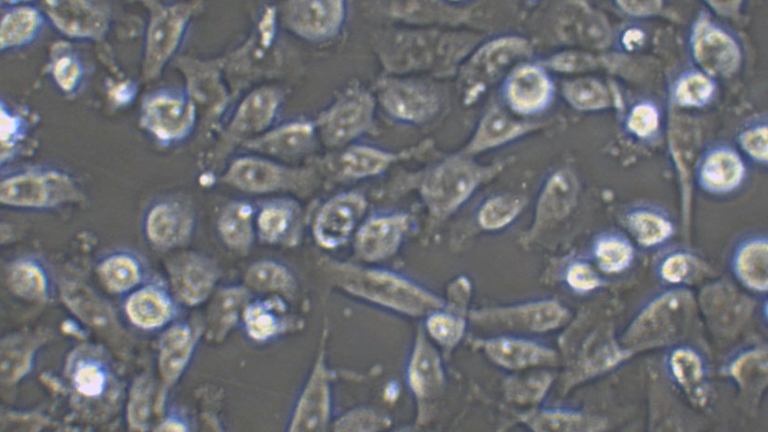 CAL-62人甲状腺癌细胞（退行性）
