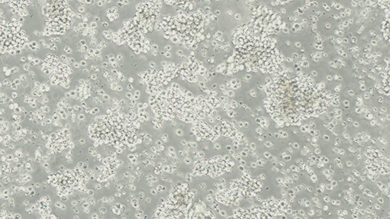 B95-8EBV转化棉顶狨淋巴细胞
