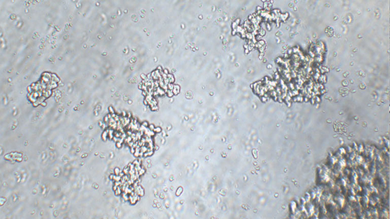 NCI-H209人小细胞肺癌细胞