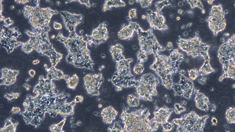 NCI-H1688人小细胞肺癌细胞