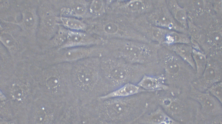 MDA-MB-157人乳腺癌细胞