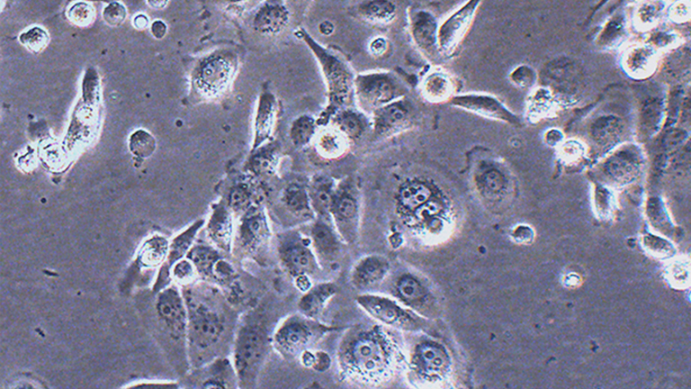 JIMT-1人乳腺癌细胞
