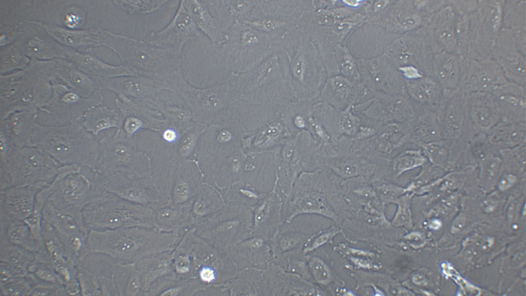 OS-RC-2人肾癌细胞