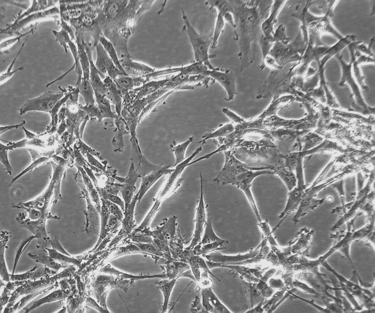 U-87 MG人脑星形胶质母细胞瘤细胞