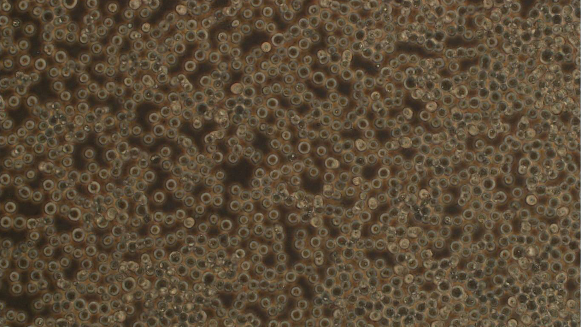 L1210小鼠淋巴细胞白血病细胞