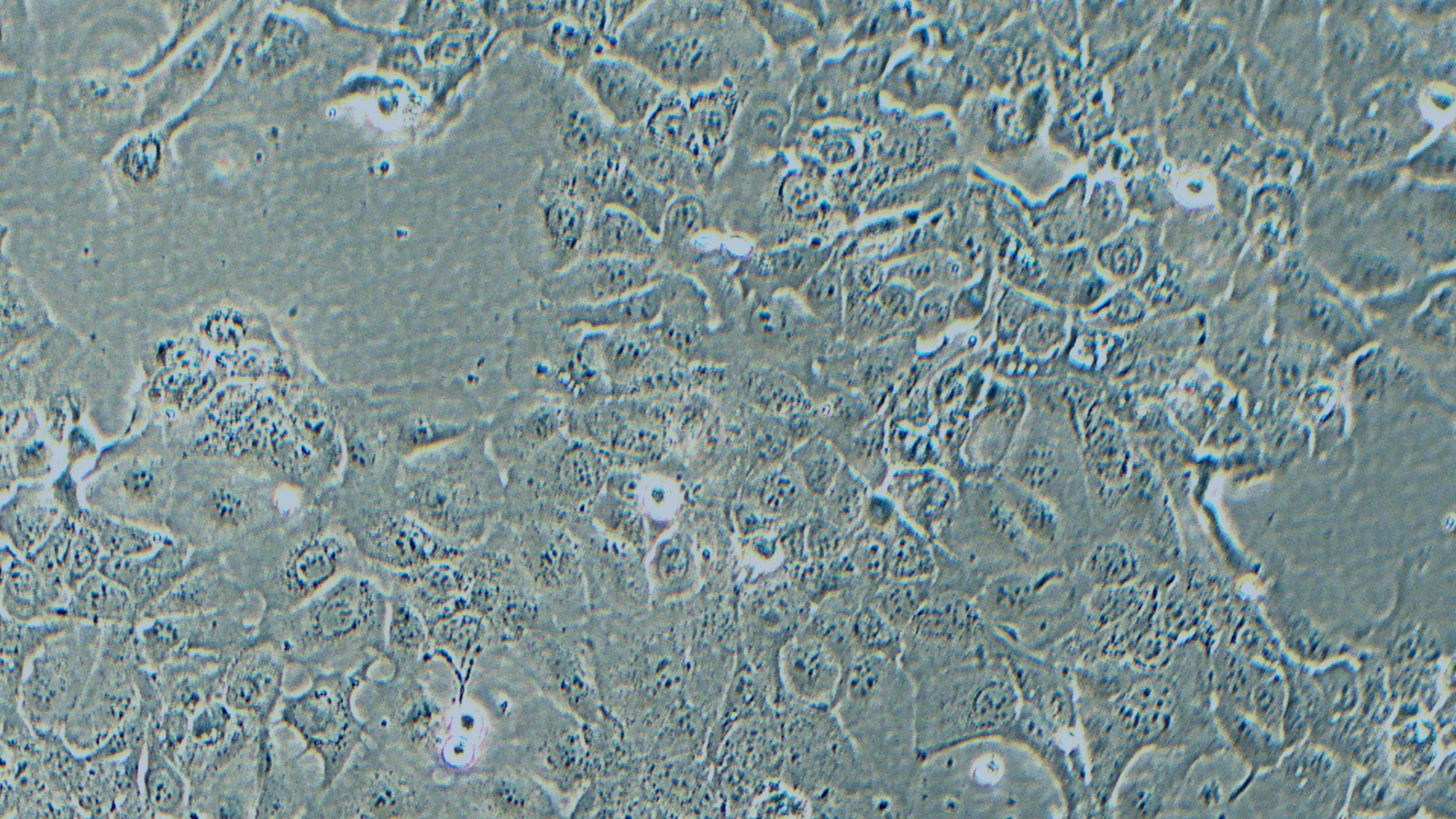 HT-1376人膀胱癌细胞