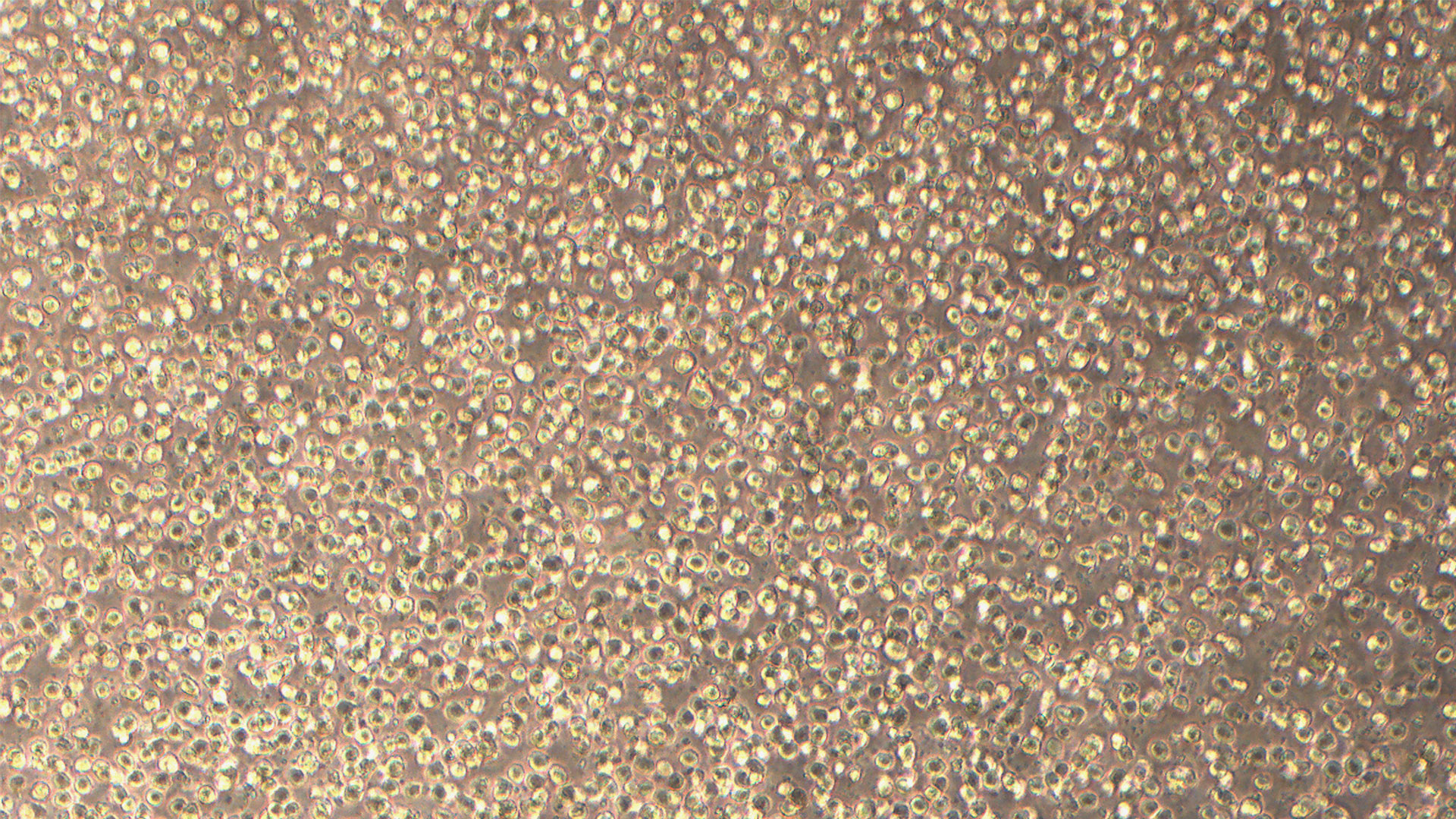 KARPAS-299 人间变性大细胞淋巴瘤细胞